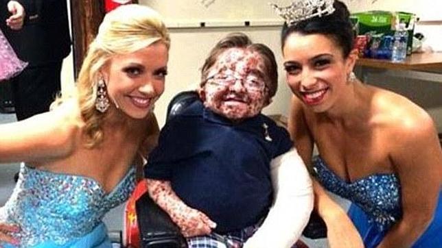 El adolescente con dos enfermedades genéticas que conquista los concursos de belleza