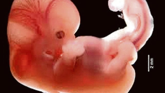Seis claves para entender los últimos cambios de la reforma de la ley del aborto