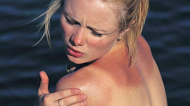 Una persona con un tono medio de piel puede sufrir quemaduras en cinco minutos con el índice UV muy alto