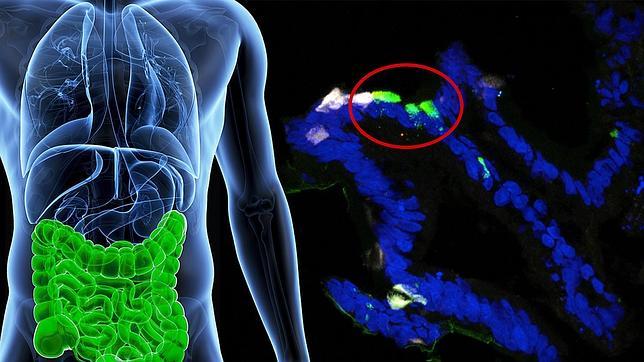 Reprograman células intestinales para producir insulina y tratar la diabetes