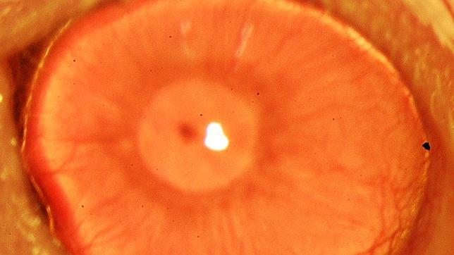 Por vez primera regeneran en vivo un córnea humana con el uso de células madre adultas