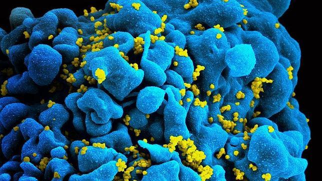 La nueva «era de la terapia génica» más cerca de erradicar el virus del sida