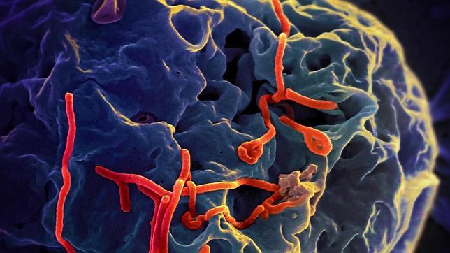 Descubren cómo el virus ébola engaña a las defensas del organismo