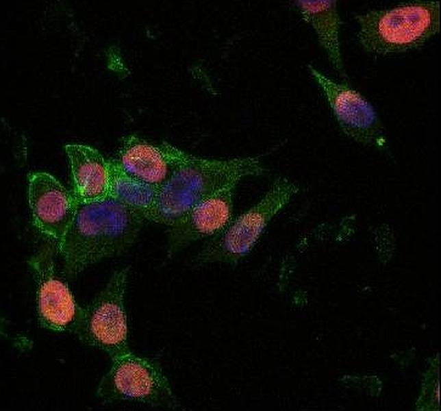 Descubren una proteína clave para entender el poder regenerativo de las células madre
