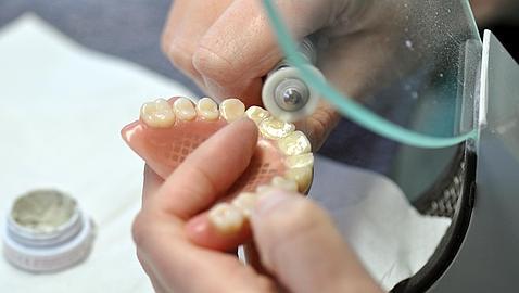 Implantes dentales, mitos y mentiras