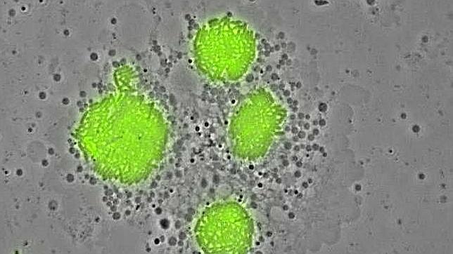 Dos nuevos fallecidos por el brote de legionela en Cataluña
