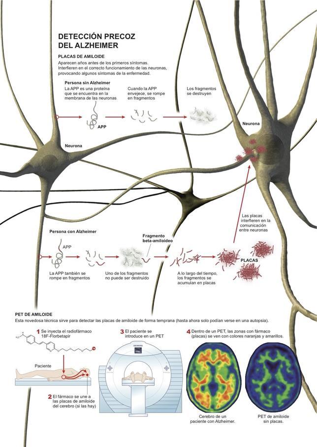 Un día para no olvidar