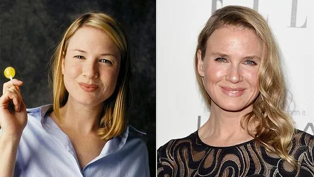 Renée Zellweger, antes y después de la cirugía estética