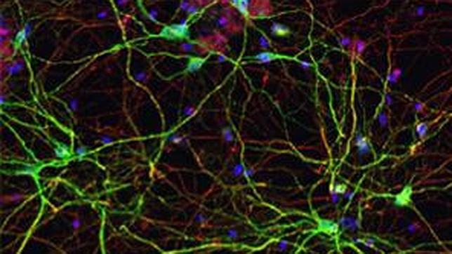 Imagen de las neuronas espinosas medianas