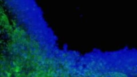 Células encapsuladas con toxinas (azul) eliminan las células tumorales (verde)