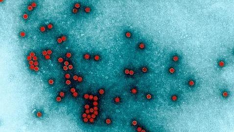 Virus de la polio