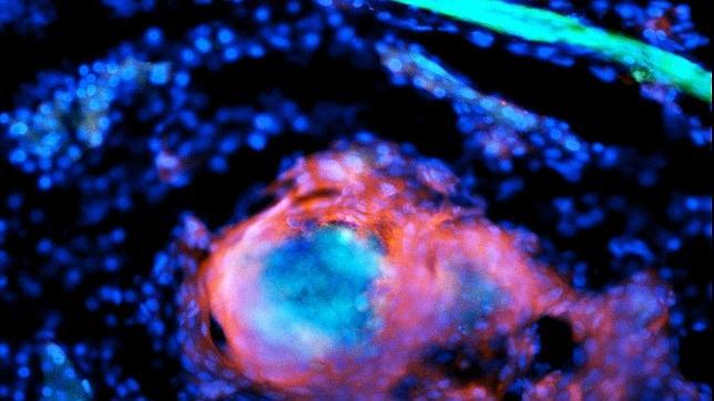 Cuando el pez cebra es  infectado con Mycobacterium marinum (azul), las células inmunes (rojo) rodean rápidamente las bacterias para formar pepitas bien organizados llamados granulomas. En pocos días, los vasos sanguíneos (verdes) comienzan a brotar en y alrededor de estas pequeñas bolas de células.