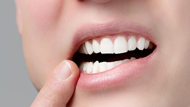 Hipersensibilidad dental: cuando los dientes duelen