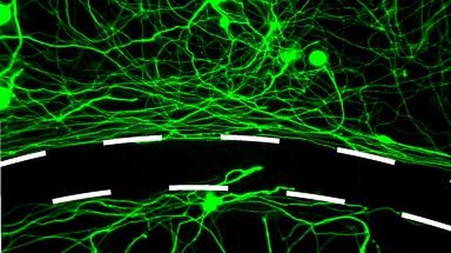 Un fármaco regenera el crecimiento nervioso en ratas con lesión medular