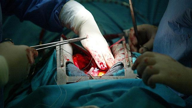 Una operación de corazón