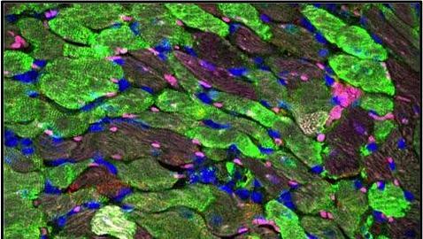 Imagen aumentada del corazón. Las células en color verde representan los cardiomiocitos que han sido sometidos a la terapia génica