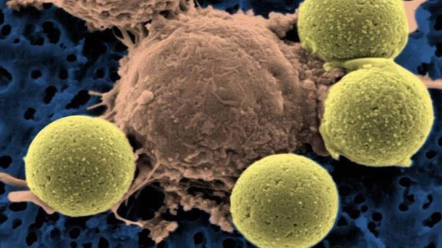 Imagen de microscopio de células T modificadas genéticamente