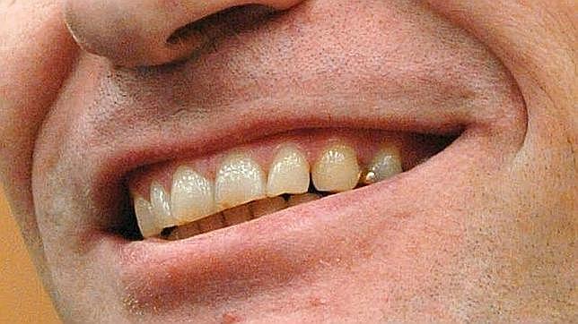 La dentadura de un hombre mientras sonríe