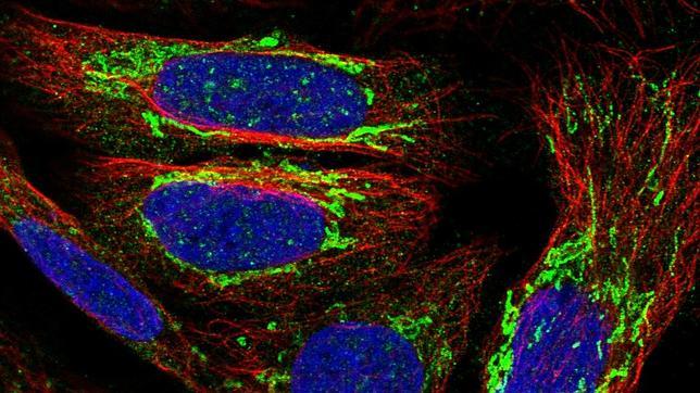 Las proteínas del cáncer al descubierto