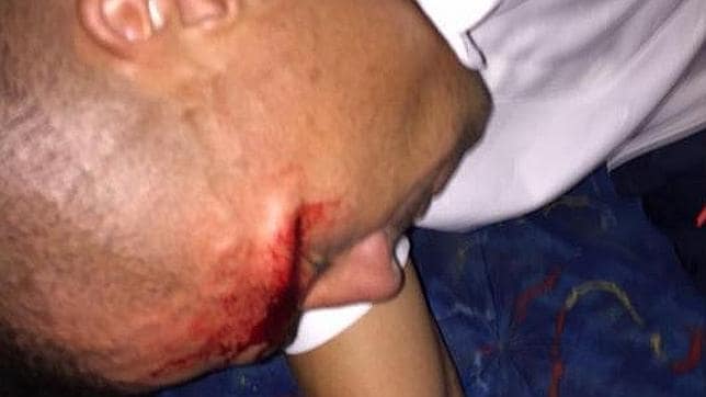 Vladimir Marín, del Independiente, herido tras el ataque al autobús del equipo