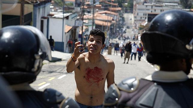 Un manifestante, manchado de sangre, reacciona ante la policía tras la muerte de un adolescente en San Cristóbal, Táchira, estado fronterizo con Colombia