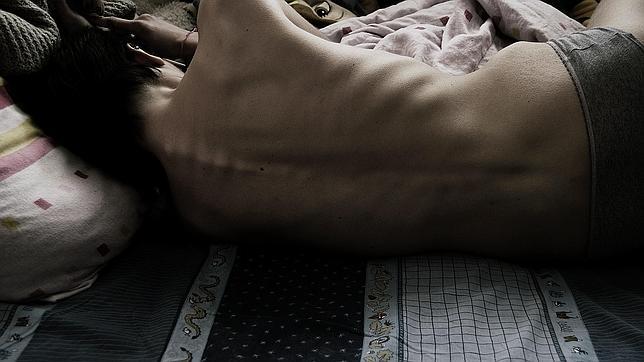 La extrema delgadez se asocia a valores como el éxito, el control sobre la voluntad y la belleza