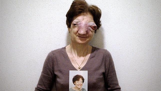 El caso de Chantal Sébire, enferma de un cáncer irreversible, abrió la polémica en 2008