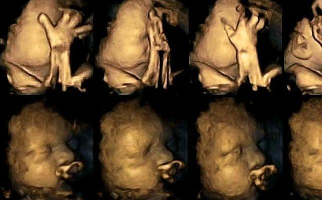 Increíbles imágenes de cómo afecta el tabaco a los bebés no nacidos