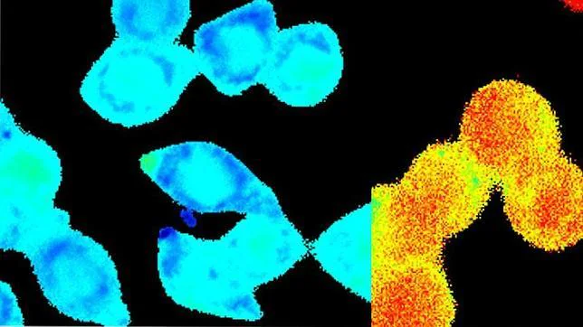 Científicos descubren niveles elevados de calcio en las células de cáncer colorrectal