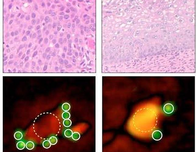 El smartphone que detecta el cáncer