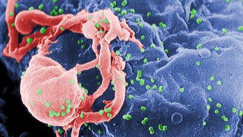 VIH infectando una célula