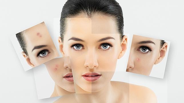 Cinco alimentos que estropean la piel