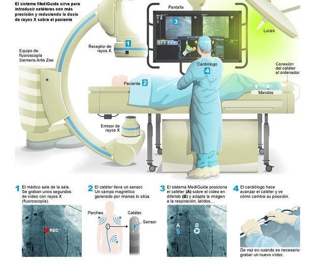 Un GPS para los vasos sanguíneos