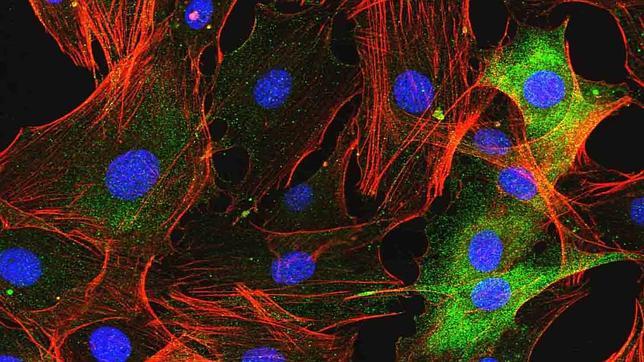 Un fármaco para la artritis reumatoide abre una nueva vía de tratamiento