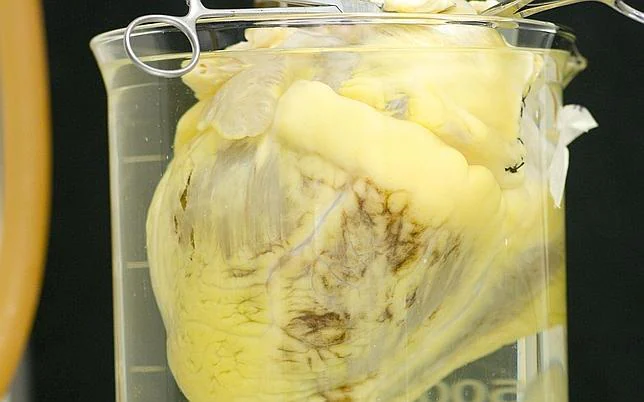 Fabrican «parches» de células madre para reparar corazones infartados