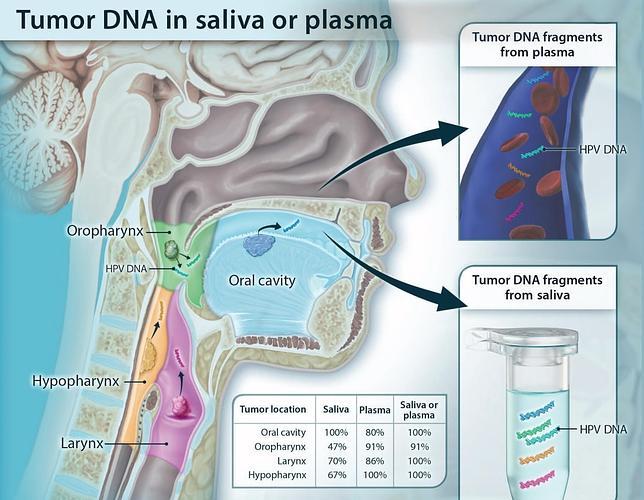 Un sencillo test de saliva o sangre detecta el cáncer de cabeza y cuello