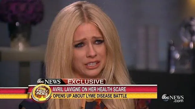 Avril Lavigne, entre lágrimas al hablar de su enfermedad de Lyme, provocada por una garrapata