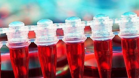 Un test de sangre define qué pacientes con artritis reumatoide fracasarán en su terapia