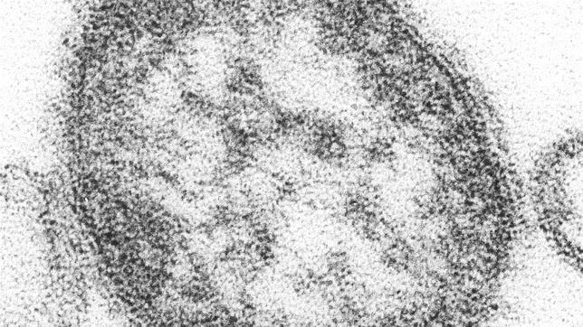 Fotografía del virus del sarampión, al microscopio electrónico