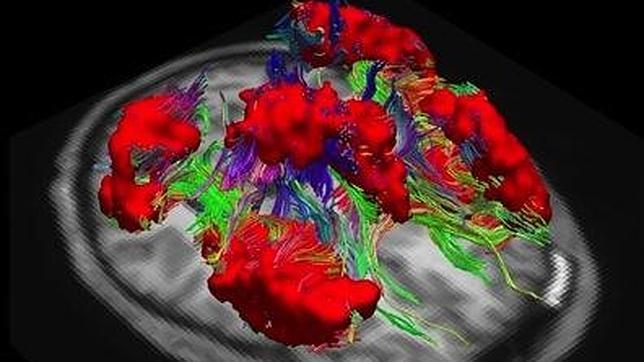 Dibujan un nuevo atlas del cerebro clave para estudiar el alzhéimer o el párkinson