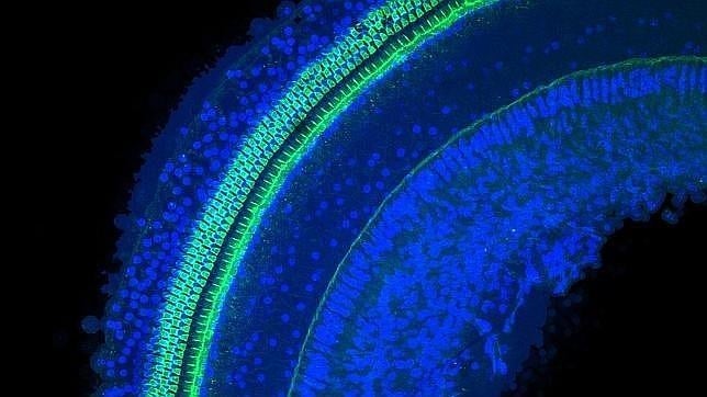 Diseñan un implante para que los sordos alcancen «percepciones inalcanzables»