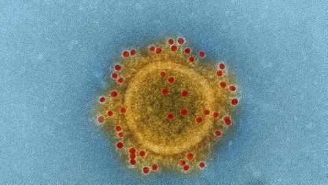 Una vacuna se muestra eficaz frente al coronavirus MERS en macacos