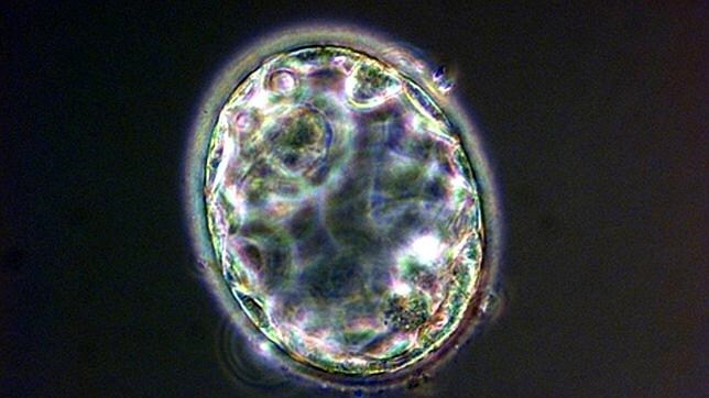 Imagen de un embrión humano