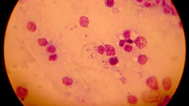 La primera vacuna europea contra la leishmaniasis visceral se probará en humanos en 2016