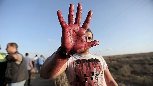 Un habitante de la franja de Gaza muestra su mano ensangrentada tras los enfrentamientos con soldados israelíes en los que murieron cinco jóvenes palestinos
