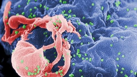 VIH infectando linfocitos