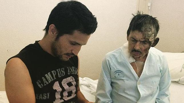 Prenden fuego a un sin techo mientras dormía en un cajero