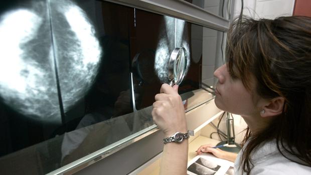 Una facultativo observa una mamografía