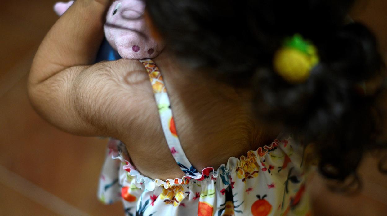 Una de las menores a las que le ha crecido vello en todo el cuerpo por tomar omeprazol defectuoso