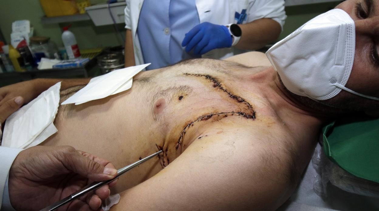 La cornada del hemitórax izquierdo tuvo cuatro trayectorias alrededor del corazón